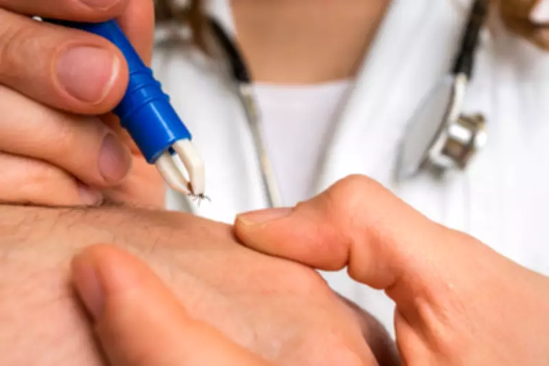 Tick Bite ER Visits Surge to Decade High in US, Experts Urge Caution