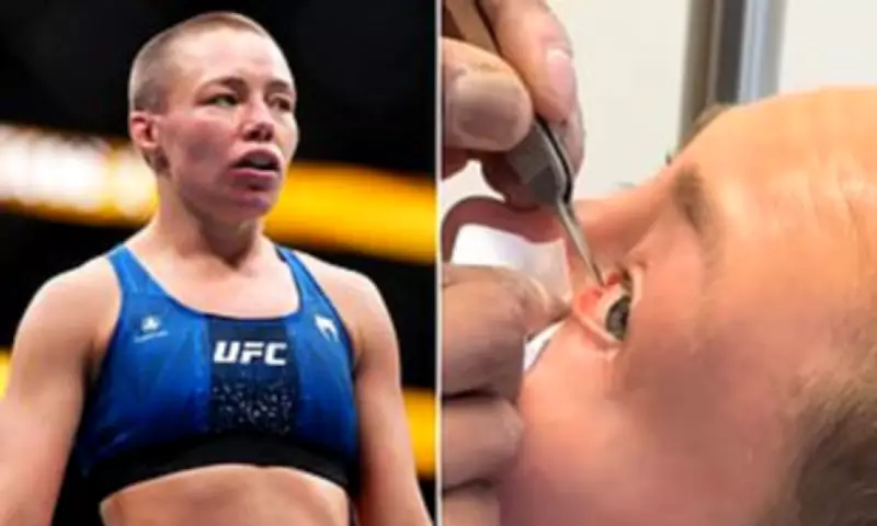 UFC Star Rose Namajunas Undergoes Eye Surgery After Gruesome Poke