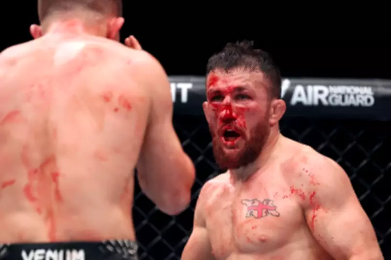 UFC Star's Title Shot in Doubt After 'Stupid Accident' Breaks Nose