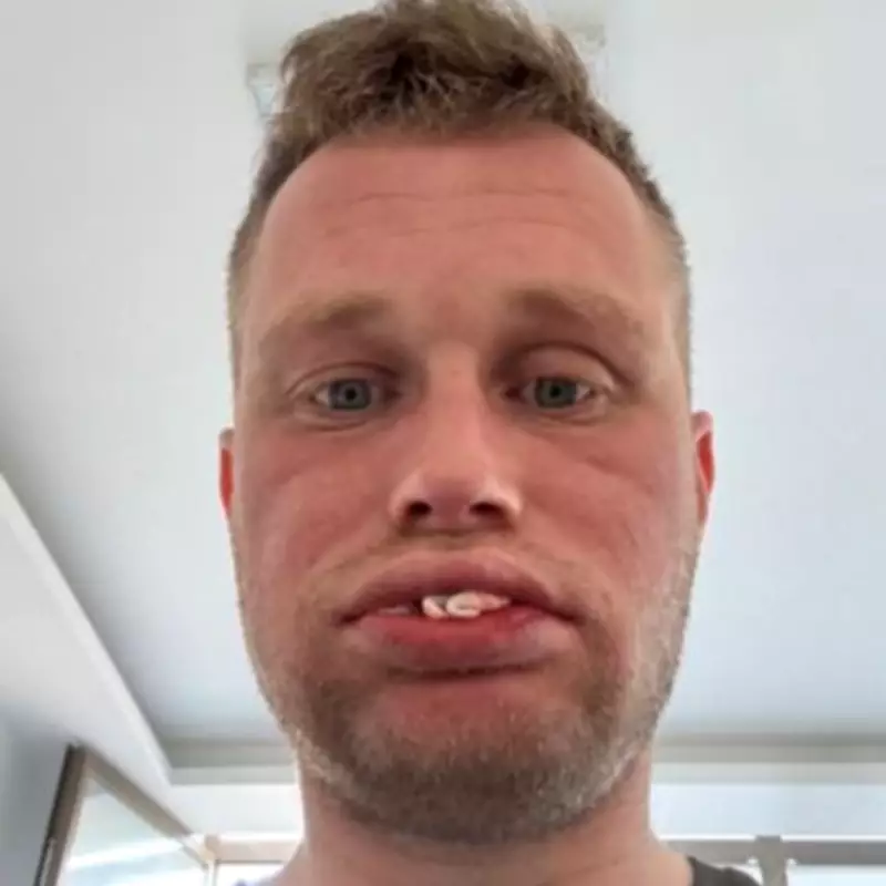 UK Dad's £3,500 Turkey Dental Trip Leaves Him Toothless After Implants Fail