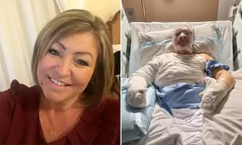 Woman Permanently Disfigured After Ethanol Fireplace Explosion in Dream Home