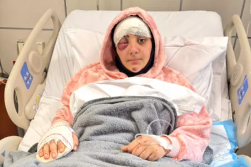 Wounded Lebanese Journalist Recounts Agony After Israeli Strike Killed Colleague