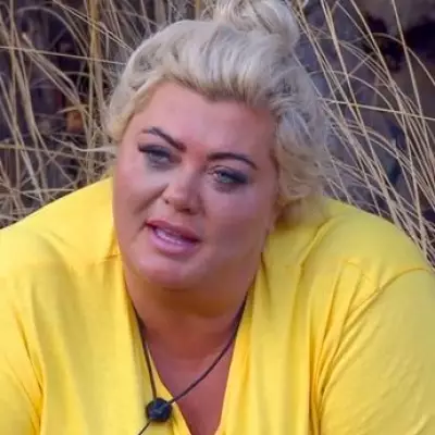 Gemma Collins Reveals Gallbladder Pain After Weight Loss Jabs