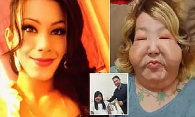 Influencer's Facial Reconstruction Paused for Breast Implant Surgery After Botched Fillers