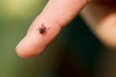 Lyme Disease Symptoms to Watch as ER Visits for Tick Bites Surge