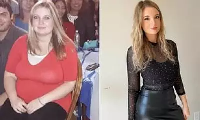 Mother's Weight Loss Struggle Reveals Incurable Lipoedema Condition