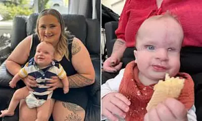 New Zealand Mother's Journey: Rare Amniotic Band Syndrome in Infant Son