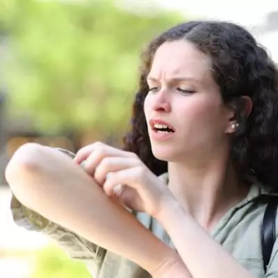 UKHSA Urges Brits to Guard Against Tick-Borne Lyme Disease Risks