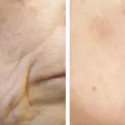 80-Year-Old Attributes Wrinkle-Free Skin to Surgeon-Recommended 89p-a-Day Drink