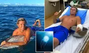 Australian Surfer's Near-Fatal Box Jellyfish Encounter in Fiji Highlights Rising Cases