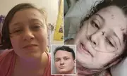 Autistic Woman Paralyzed by Drunk Driver After Achieving Independence