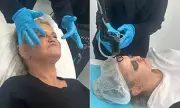 Danniella Westbrook Undergoes Laser Surgery for Skin Rejuvenation