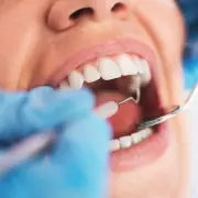 Dentist Impressed by 27p-a-Day Teeth Whitening Kit Results