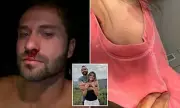 Disturbing 911 Call and Bloody Images Reveal Domestic Dispute Involving Reality Star