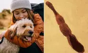 Fox Tapeworm Spreads Across US, Posing Rare but Deadly Liver Infection Risk