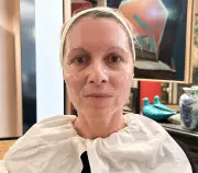 I Tried a Non-Surgical Facelift: The Results Were Surprising