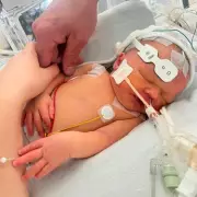 Inquest Hears Midwife Placed 'Blue and Floppy' Newborn on Mother's Chest