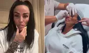 Katie Price Admits Botox Left Her Face 'Distorted' and Struggling to Speak
