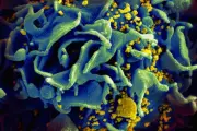 Man 'Cured' of HIV After Brother's Rare Genetic Mutation: 'Like Winning Lottery Twice'