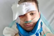 Man's Eye Rebuilt After Eight Surgeries Following Car Crash