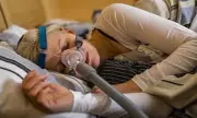 New Implant Offers Hope for Millions with Sleep Apnea, Bypassing CPAP Machines
