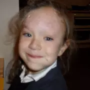 Paediatric Nurse Born with Rare Skin Condition Embraces Her Unique Look