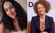 Rachel Dolezal Undergoes Melanoma Surgery After Sun Tanning