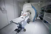 Record Cancer Cases Overwhelm NHS as UK Population Ages