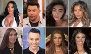 TOWIE Stars' Dramatic Transformations: Cosmetic Surgery Over 16 Years