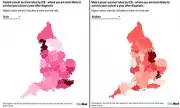 UK Cancer Survival Rates Reveal Stark Postcode Lottery, Deprivation Link