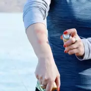 UKHSA Warns Brits of Malaria Risk for Summer Travel Abroad