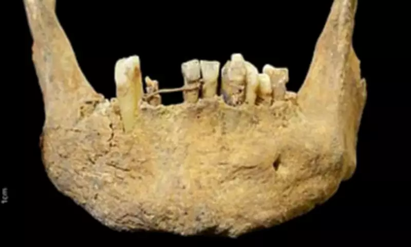 500-Year-Old Gold Dental Bridge Found in Scotland Predates Modern Grillz
