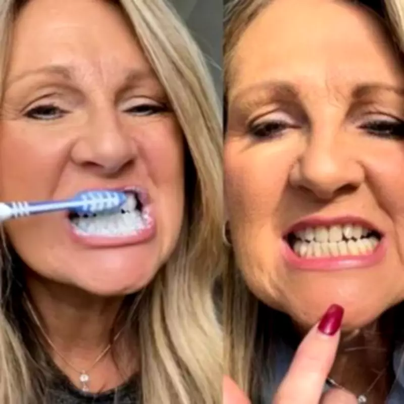 63-Year-Old Woman Says Teeth Look 20 Years Younger After £11 Whitening