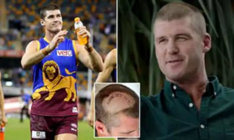 AFL Legend Jonathan Brown Reveals Brain Tumour Battle and Recovery