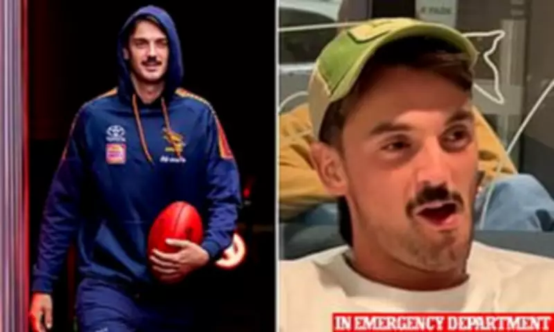 AFL Star Luke Nankervis' Lockjaw TikTok Goes Viral with Over 100K Views