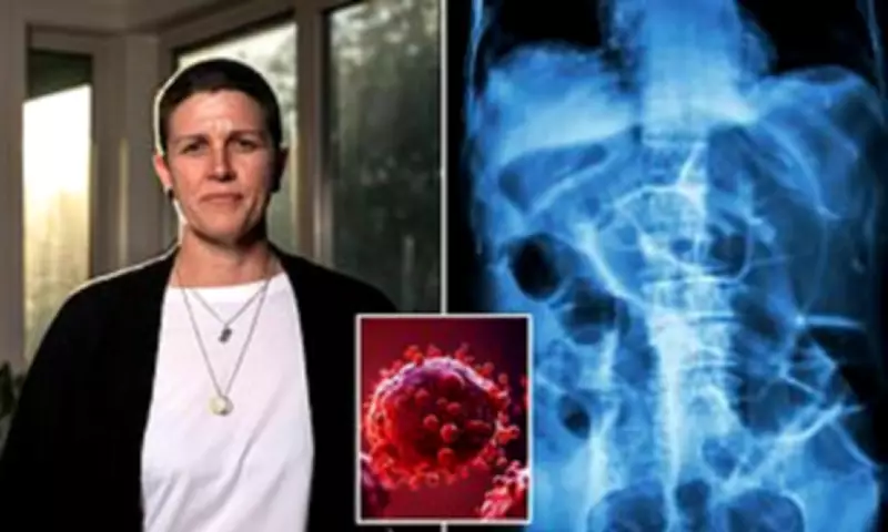 Bowel Cancer Rates Triple in Young Australians: Urgent Need for New Care Models