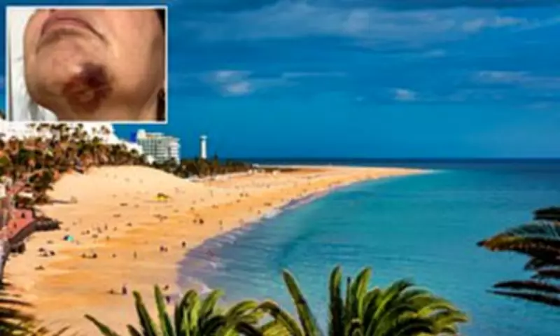 British grandmother wins £23,000 after fall on Fuerteventura hotel path