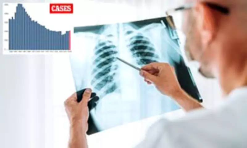 California TB Cases Hit 12-Year High: 2,150 Infections, 279 Deaths in 2025