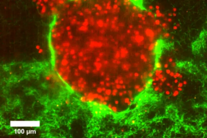 Cell Size May Explain Why Some Cancers Are More Dangerous