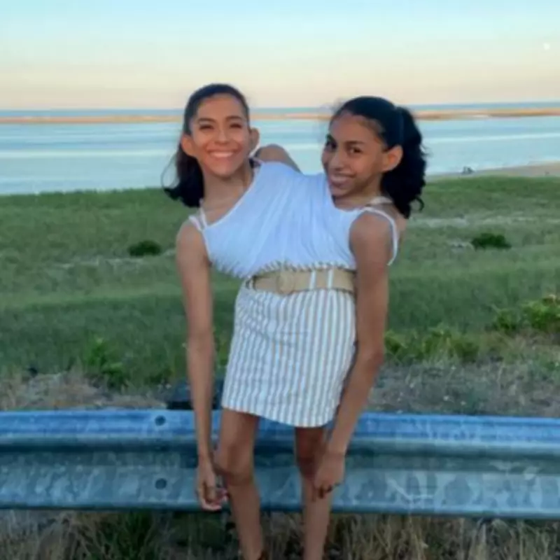 Conjoined Twins Share Spine Fears After Doctor's Grim Prognosis