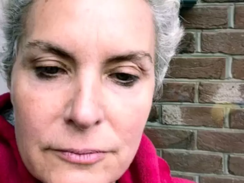 Coronation Street's Tracy Shaw Bravely Faces Hair Loss Amid Chemotherapy