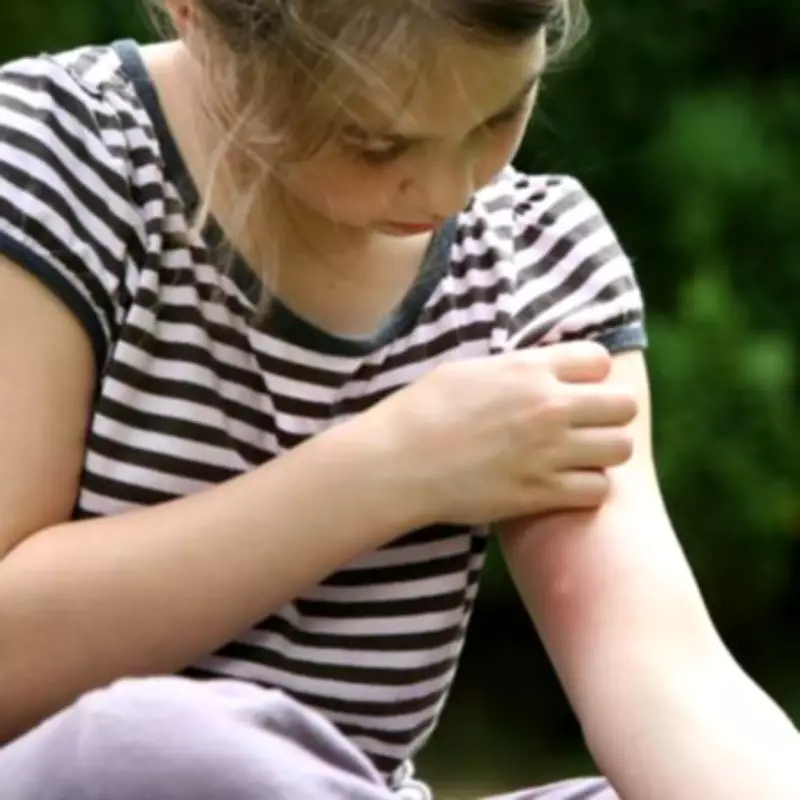 Doctor's Simple Tip to Stop Mosquito Bites Itching in Seconds
