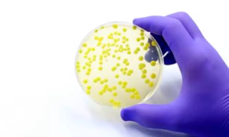 FDA Probes Salmonella Typhimurium Outbreak Sickening 16, Source Unknown