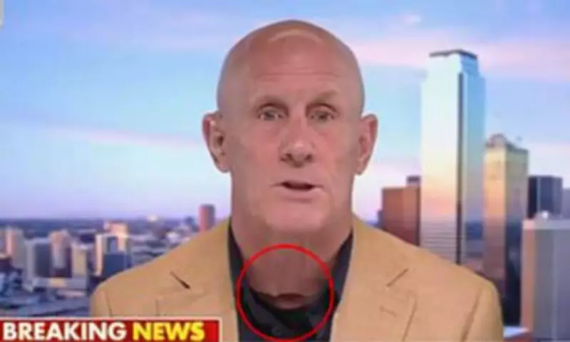 Fox News Guest's Neck Mark Sparks Mask Conspiracy Theory Debunked