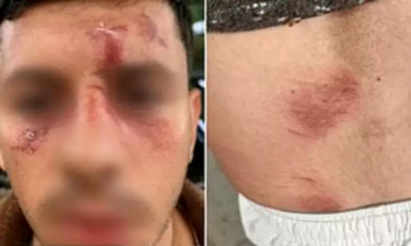 Jewish man brutally attacked in Golders Green after speaking Hebrew on phone