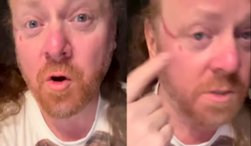Keith Lemon actor Leigh Francis clawed in face by overzealous fan during DJ set