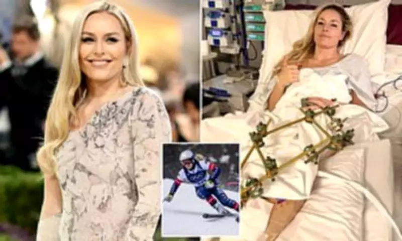 Lindsey Vonn Nominated to US Alpine Ski Team After Horrific Olympic Crash