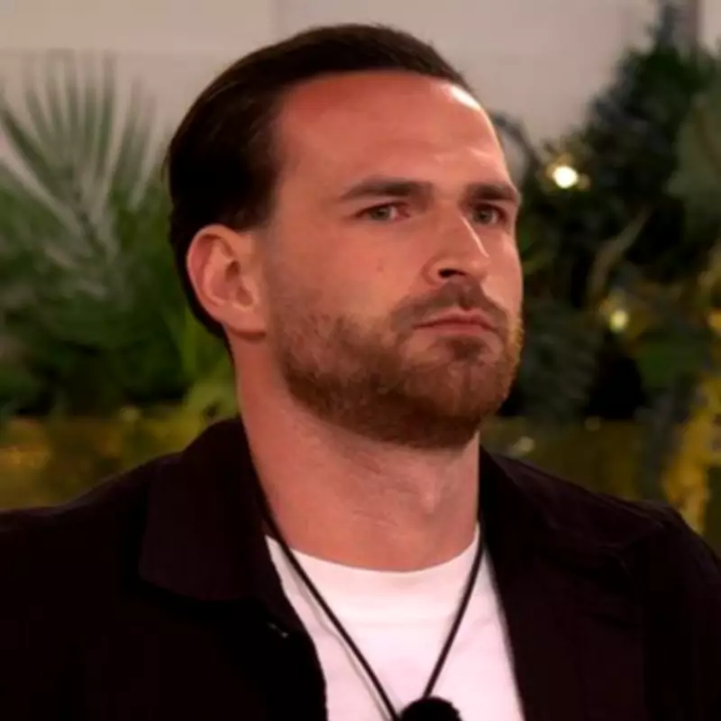 Love Island's Ronnie Vint Reveals Hair Transplant After Online Mockery