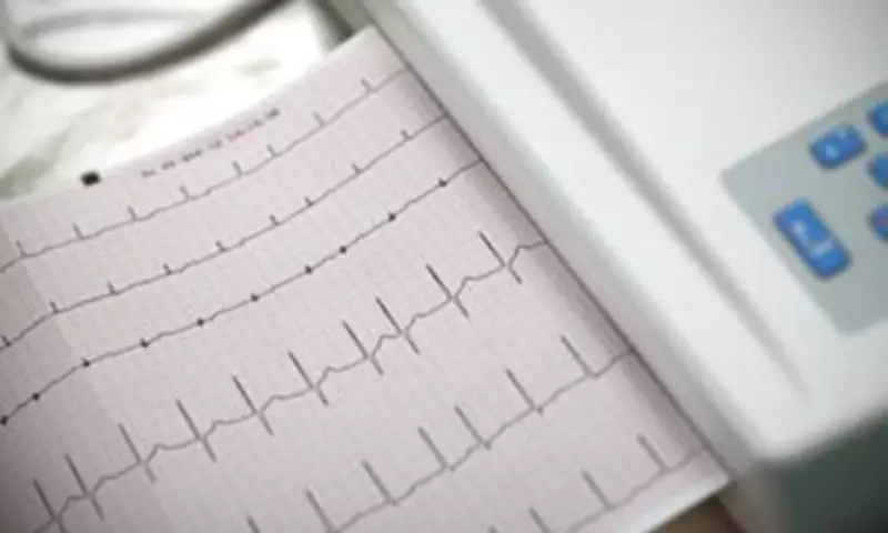 Low Resting Heart Rate May Also Signal Stroke Risk, Study Finds