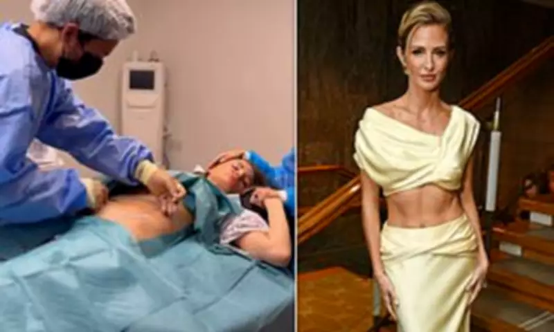 Millie Mackintosh Reveals BAFTA Abs Achieved with Skin Tightening